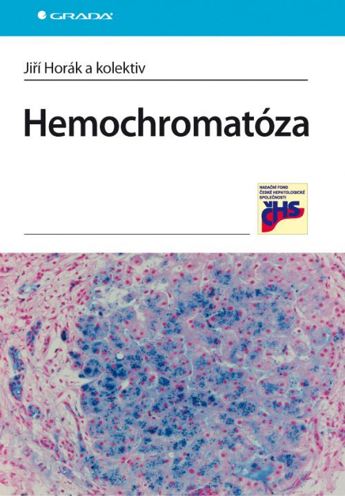 Hemochromatóza, Horák Jiří