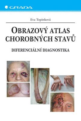 Obrazový atlas chorobných stavů, Topinková Eva