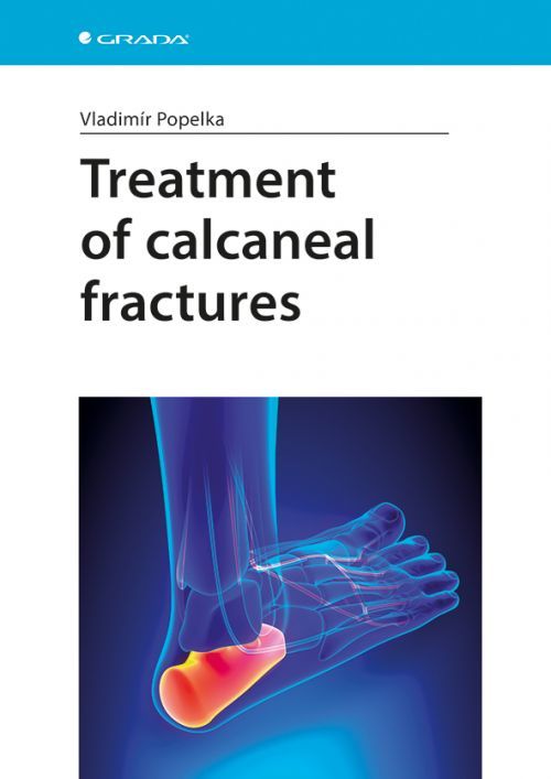 Treatment of calcaneal fractures, Popelka Vladimír