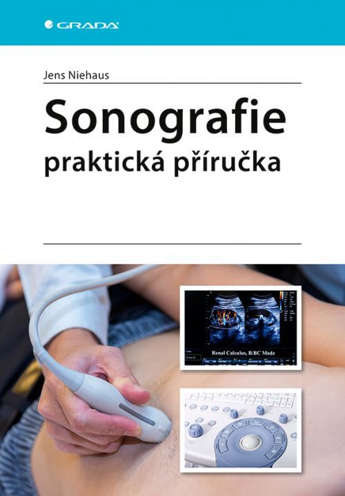 Sonografie (Praktická příručka) - Jens Niehaus