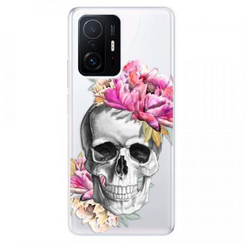 Odolné silikónové puzdro iSaprio - Pretty Skull - Xiaomi 11T / 11T Pro