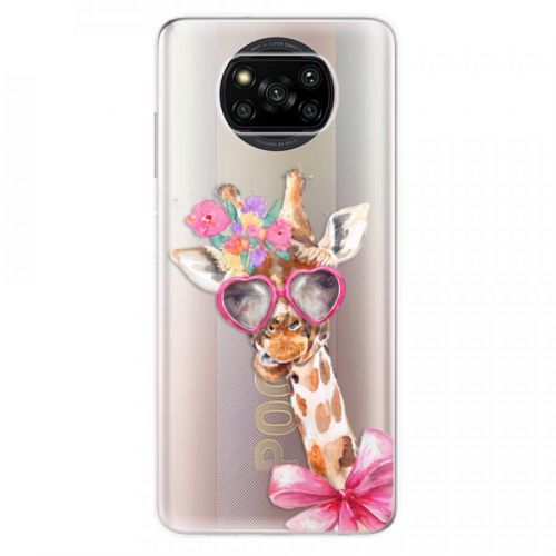 Odolné silikónové puzdro iSaprio - Lady Giraffe - Xiaomi Poco X3 Pro / X3 NFC