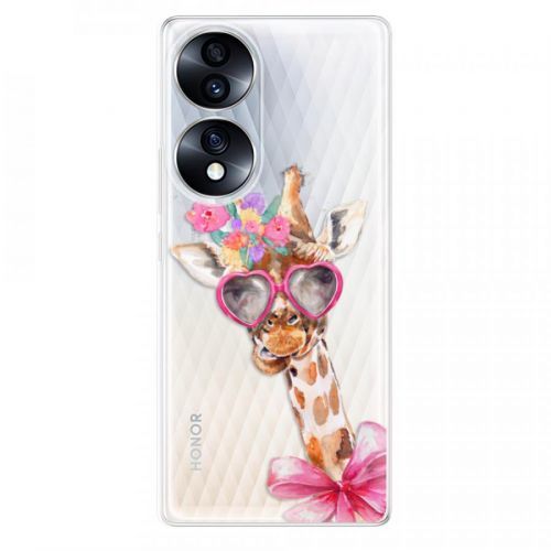 Odolné silikónové puzdro iSaprio - Lady Giraffe - Honor 70