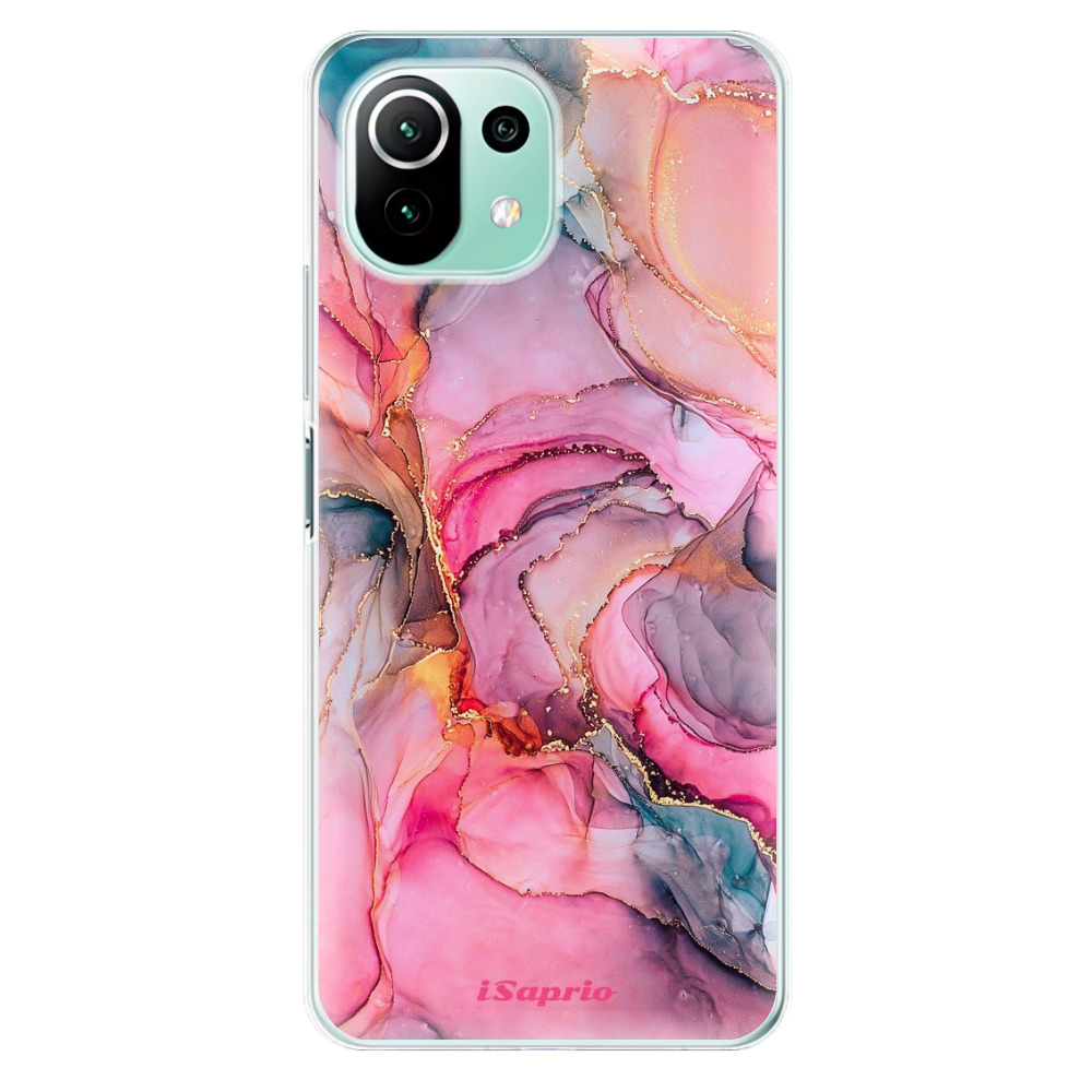 Odolné silikónové puzdro iSaprio - Golden Pastel - Xiaomi Mi 11 Lite