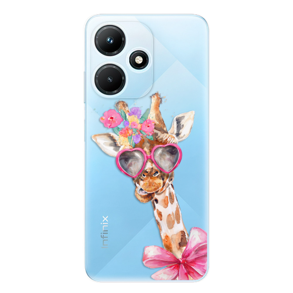Odolné silikónové puzdro iSaprio - Lady Giraffe - Infinix Hot 30i