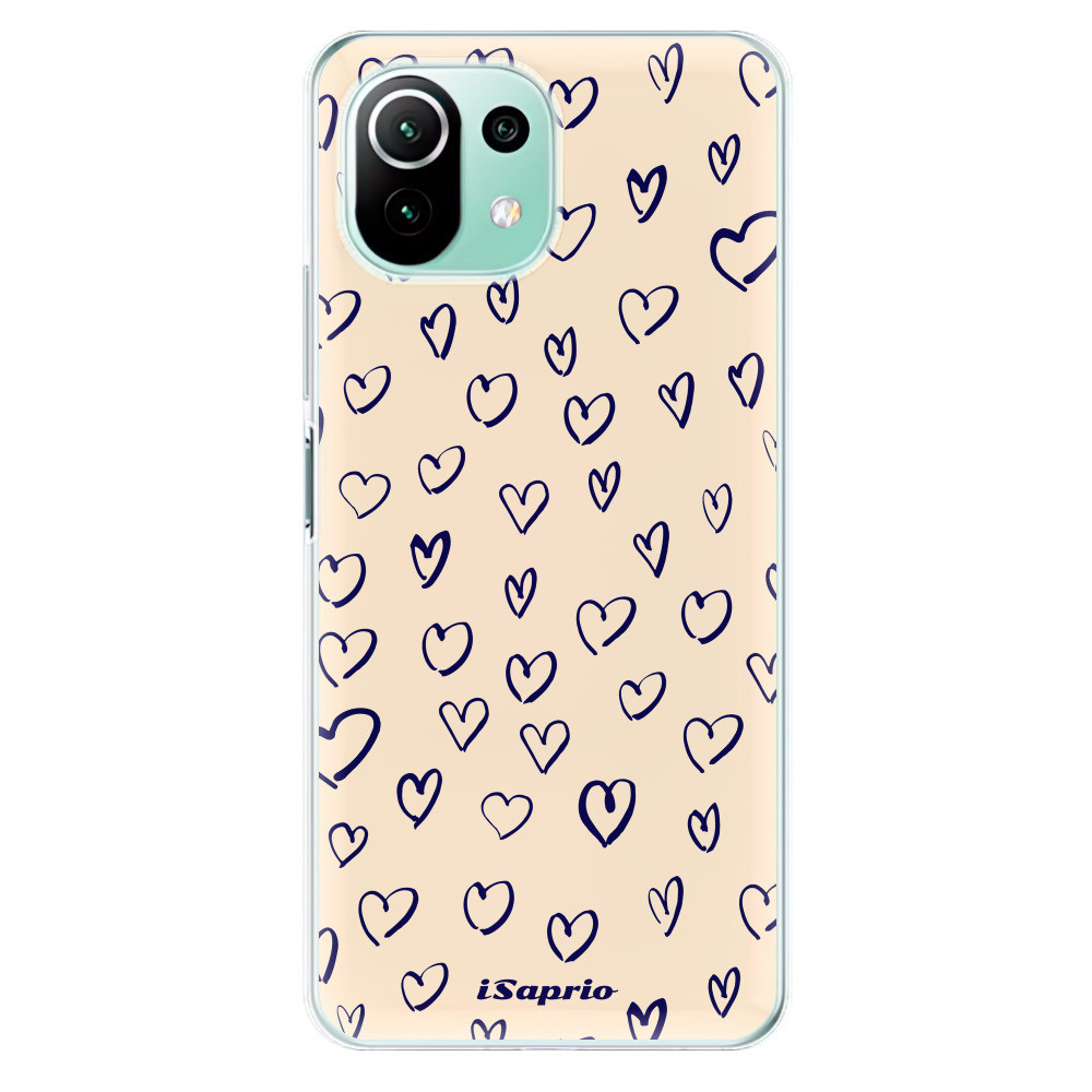 Odolné silikónové puzdro iSaprio - Heart Light - Xiaomi Mi 11 Lite