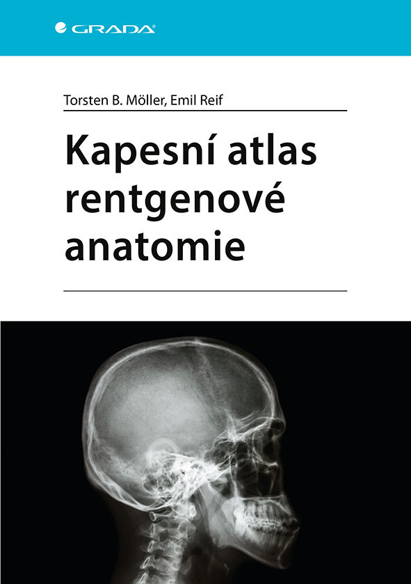 Kapesní atlas rentgenové anatomie, Möller Torsten B.