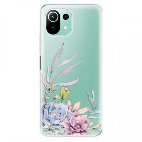 Odolné silikónové puzdro iSaprio - Succulent 01 - Xiaomi Mi 11 Lite