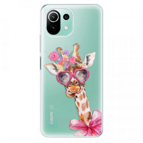 Odolné silikónové puzdro iSaprio - Lady Giraffe - Xiaomi Mi 11 Lite