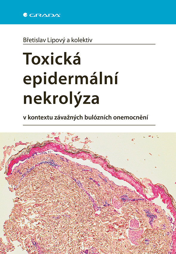 Toxická epidermální nekrolýza, Lipový Břetislav
