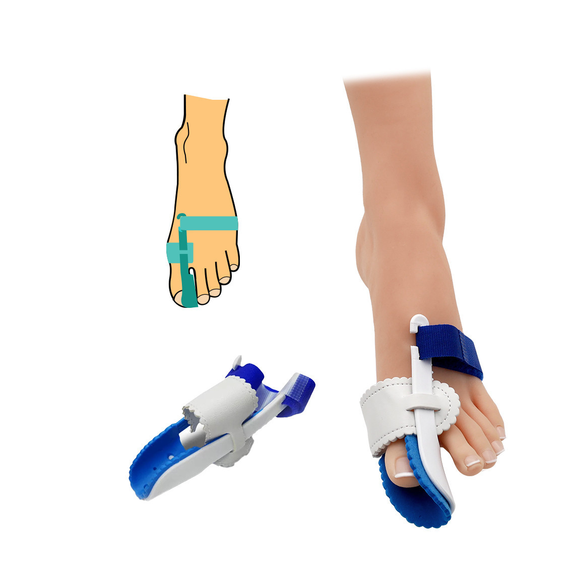 Bandáž hallux valgus HealMed 1 ks - biela-modrá, pravá