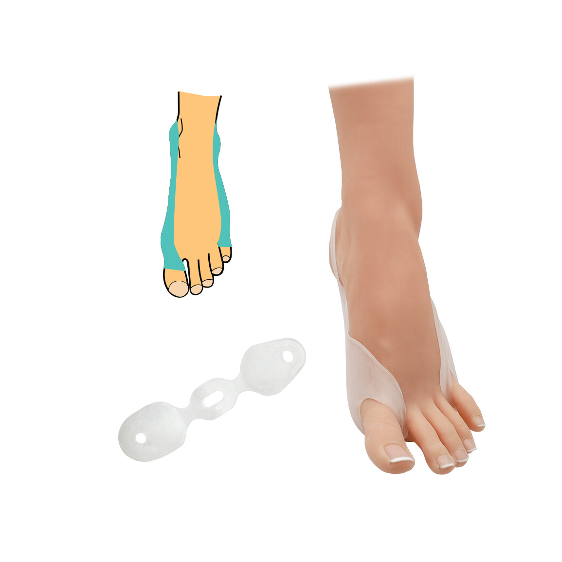 Bandáž hallux na oddelenie palca a malíčka - priehľadná