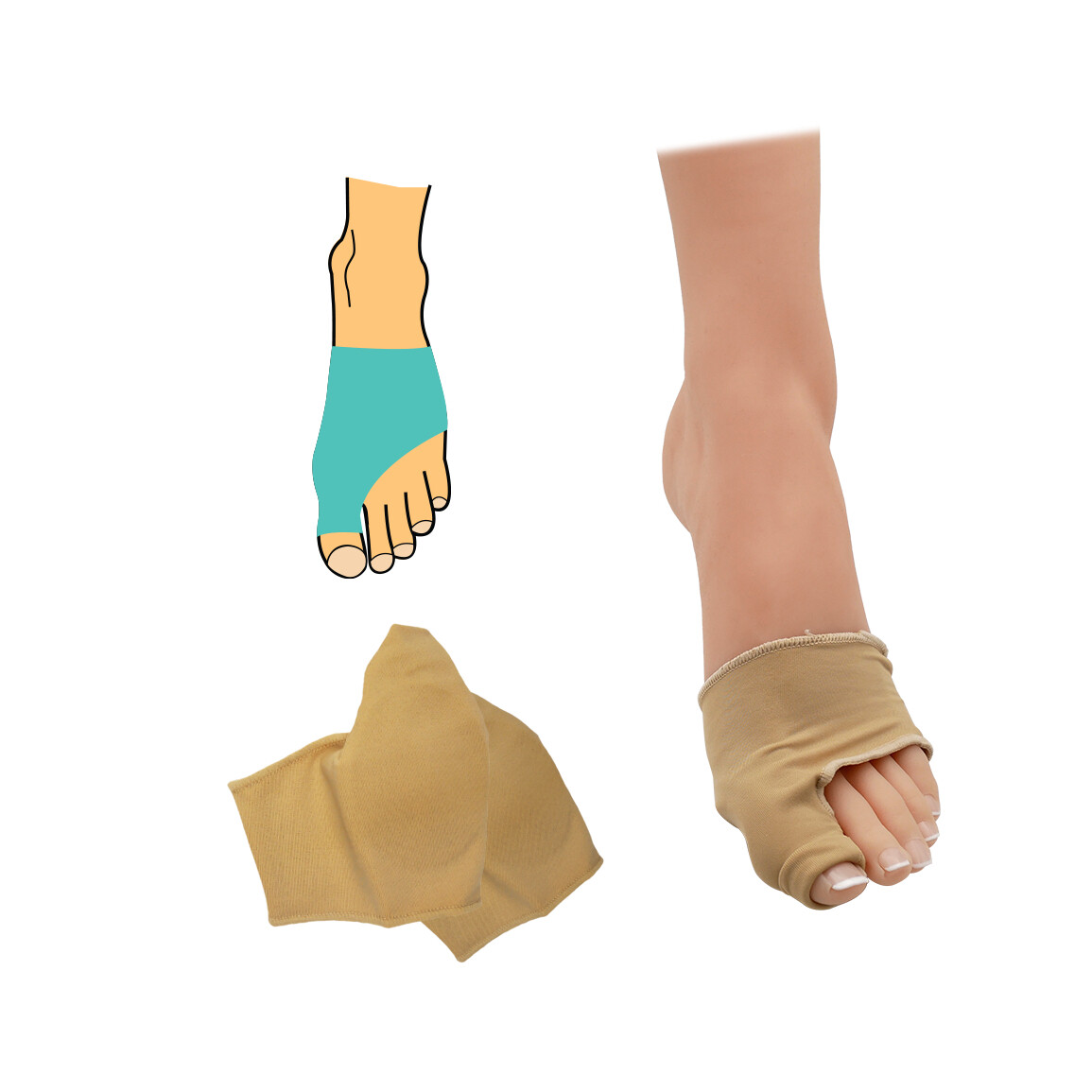 Bandáž Hallux valgus 1 ks - béžová