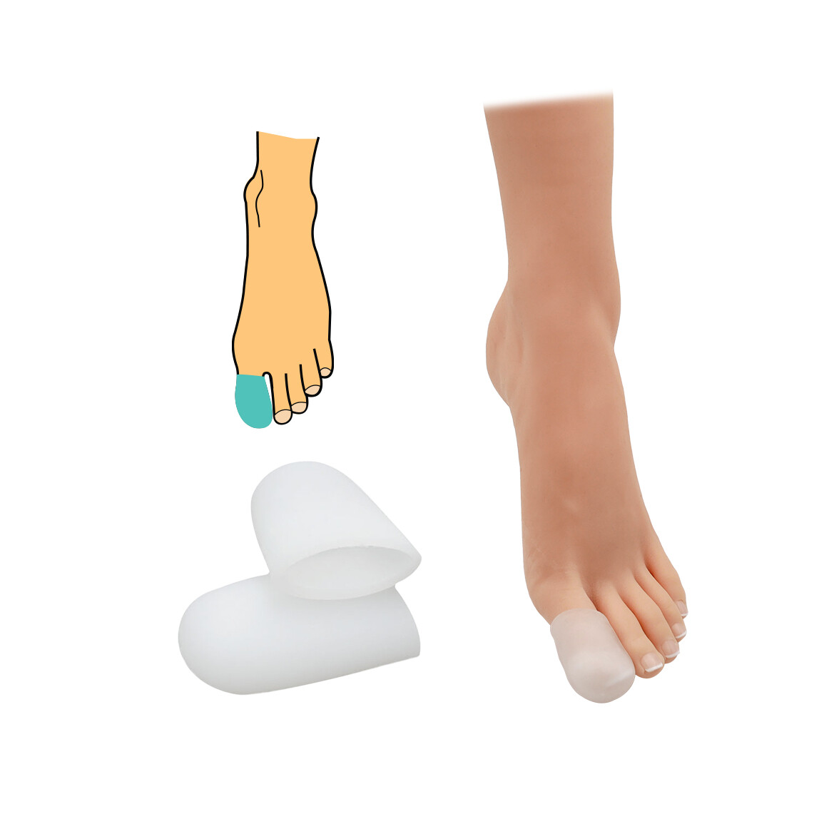 Chránič palca uzavretý HealMed 2 ks - priehľadný