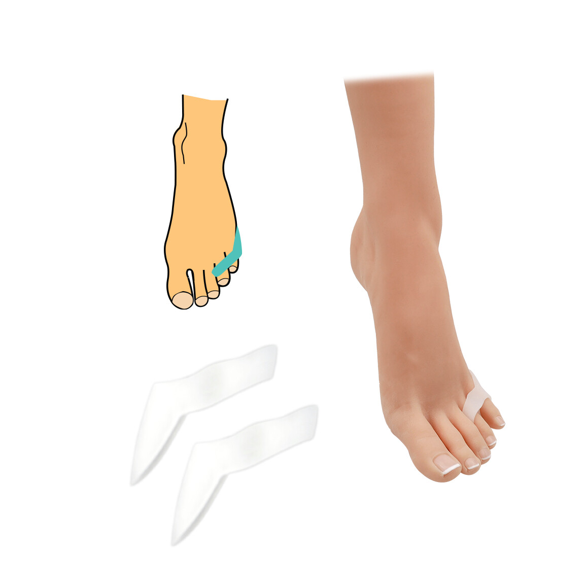 Korektor s návlekom na prst a malíček s chráničom 1 pár - priehľadný