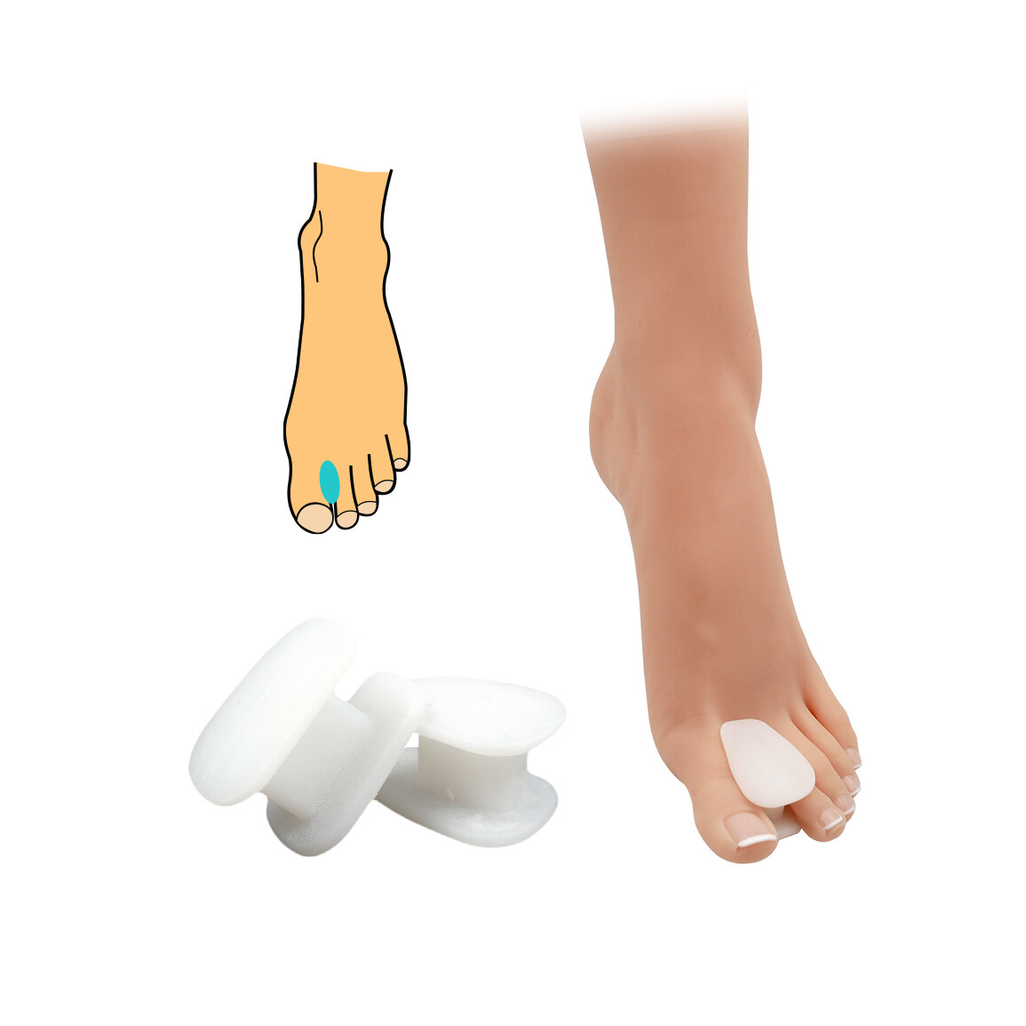 Korektor vybočeného palca HealthMed 1 pár - priehľadný