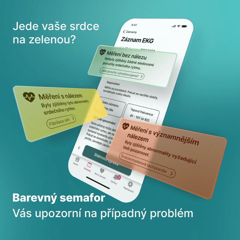 KARDI AI 12-mesačné EKG monitorovanie srdca XS-S