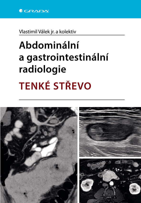 Abdominální a gastrointestinální radiologie, Válek jr. Vlastimil