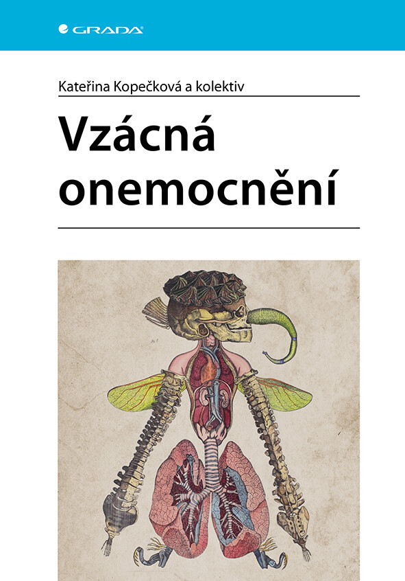 Vzácná onemocnění, Kopečková Kateřina
