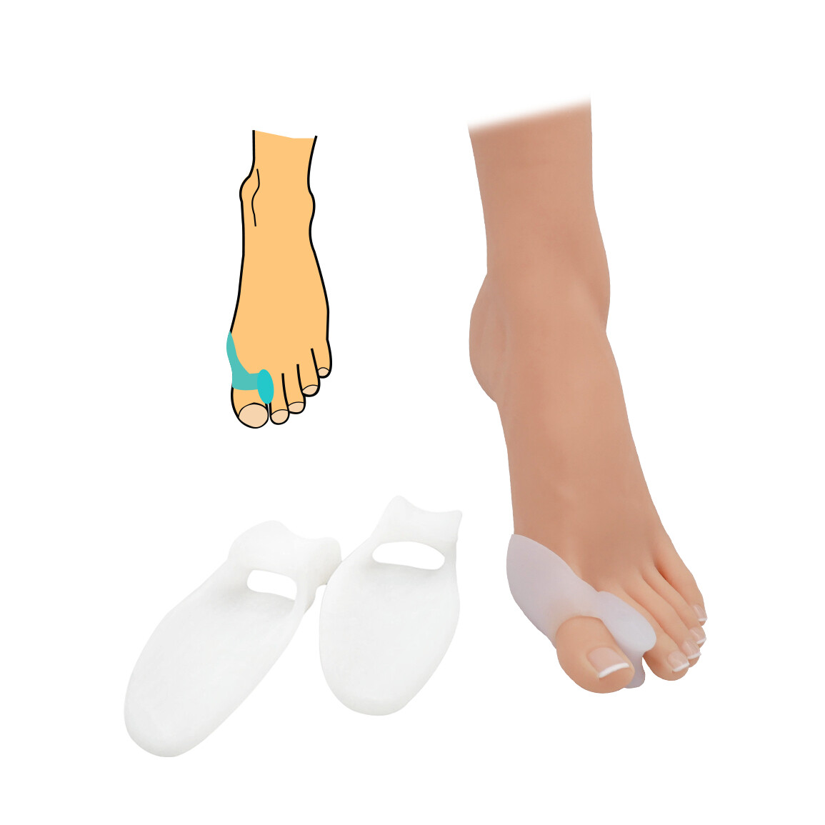 Chránič a korektor Hallux valgus HealMed 2 ks - priehľadný