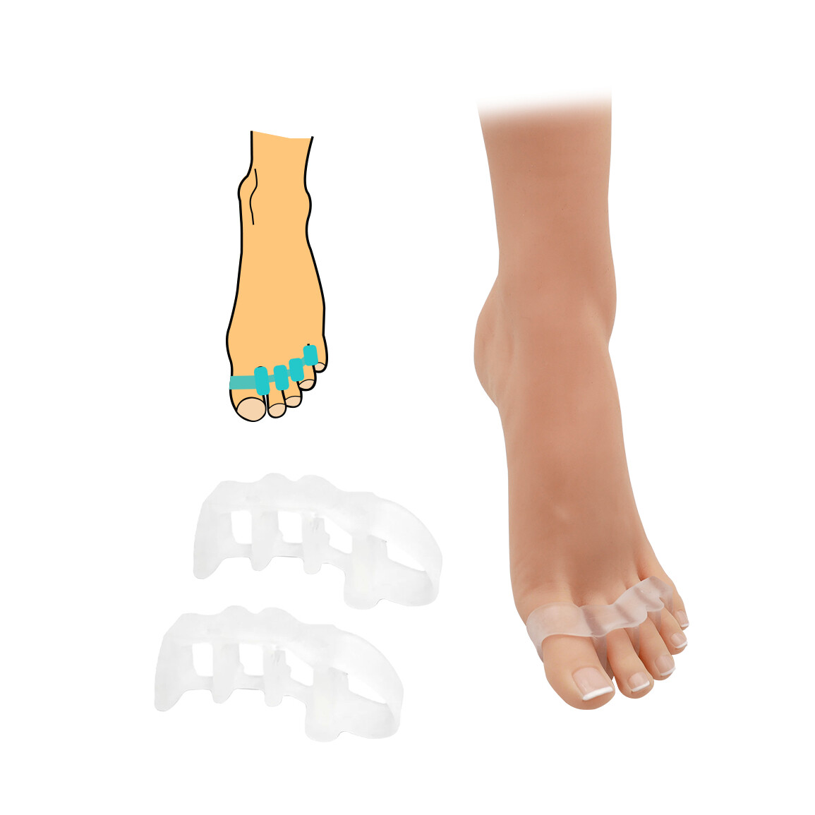 Medziprstný oddeľovač HealMed 2 ks - priehľadný