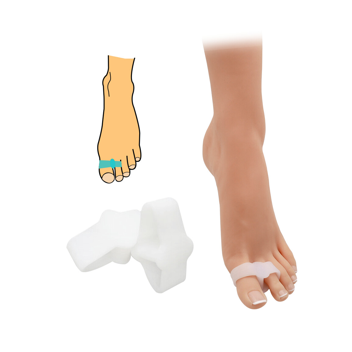 Korektor hallux valgus s návlekom na prst a palec HealMed 2 ks - priehľadný