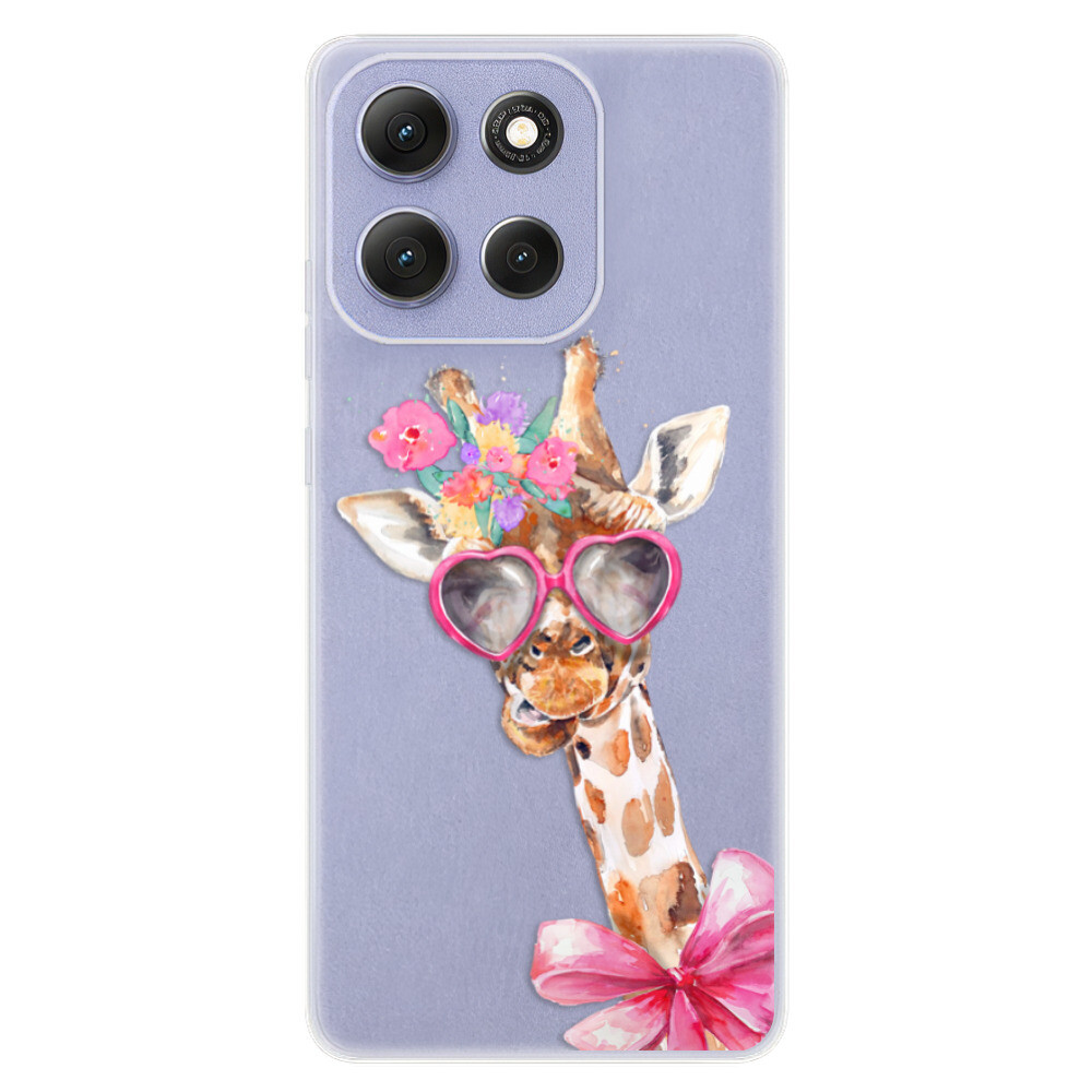 Odolné silikónové puzdro iSaprio - Lady Giraffe - Motorola Moto G86 5G