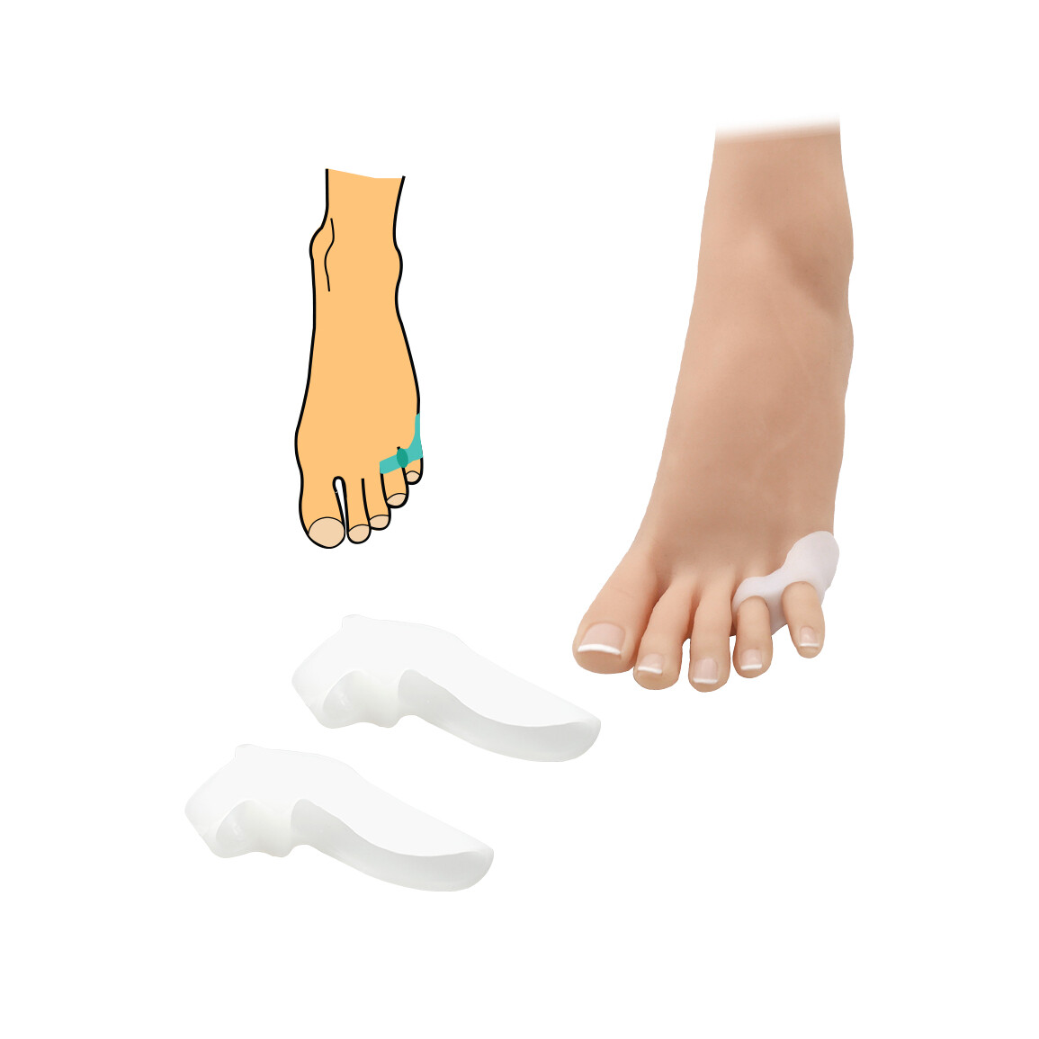 Korektor na malíček s návlekom HealMed 1 pár - biely