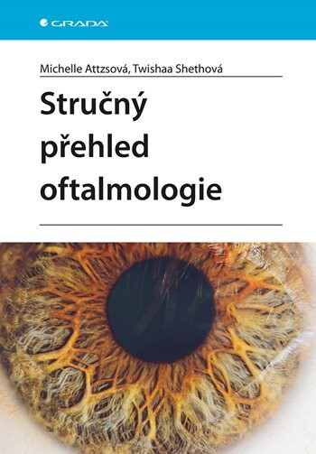 Stručný přehled oftalmologie, Attzsová Michelle