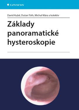 Základy panoramatické hysteroskopie - David Kužel, Dušan Tóth, Michal Mára a kolektiv