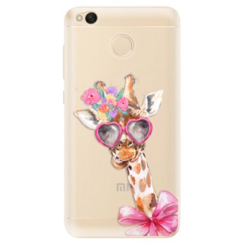 Odolné silikónové puzdro iSaprio - Lady Giraffe - Xiaomi Redmi 4X